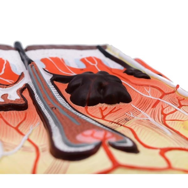 Eisco Scientific Human Skin Model, 300x Enlarged, Mounted on Base, 13"x10" - AM0318