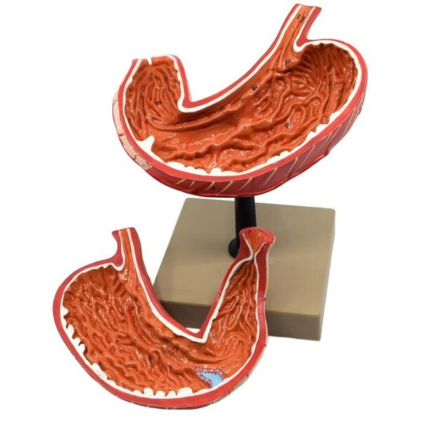 Eisco Scientific Human Stomach Model, 2 Parts, 3-D, Sectional View, Mounted, 5"x5"x7.5" - AM0085