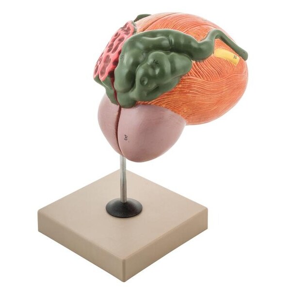 Eisco Scientific Human Urinary Bladder w/Prostate Model, 2 Parts, 3xLife Size, 8"x8"x6" - AM0113