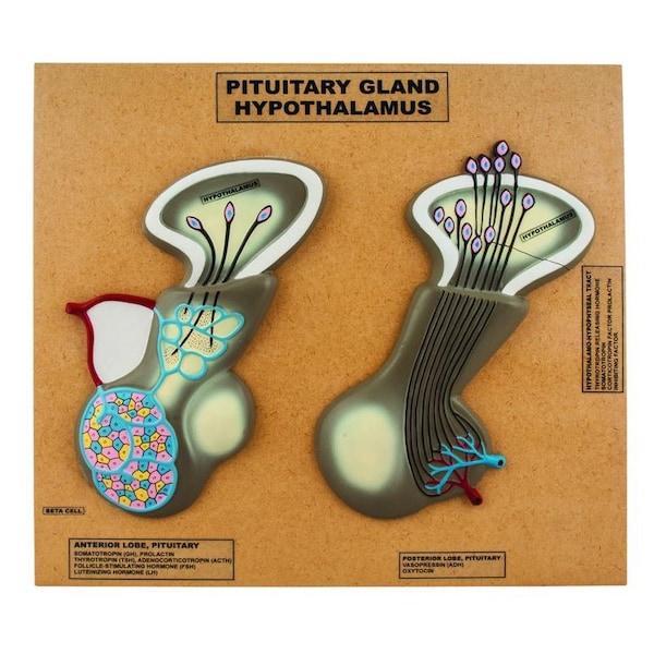Eisco Scientific Model of Pituitary Gland and Hypothalamus, Greatly Enlarged: - AM0254