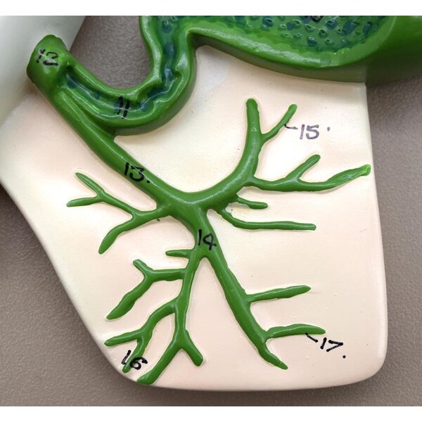 Eisco Scientific Human Pancreatic Duct Model, 3-D, Mounted on Base, 10"x7" - AM0330