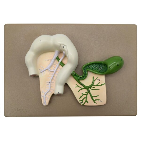 Eisco Scientific Human Pancreatic Duct Model, 3-D, Mounted on Base, 10"x7" - AM0330