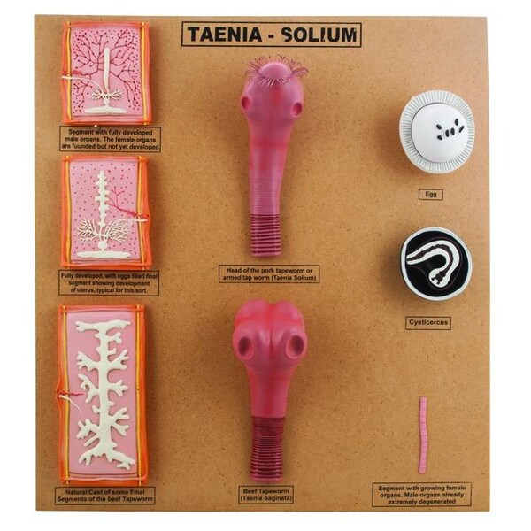 Eisco Scientific Large Tape Worm Taenia Sodium Scolex Comparison Model - ZM0030