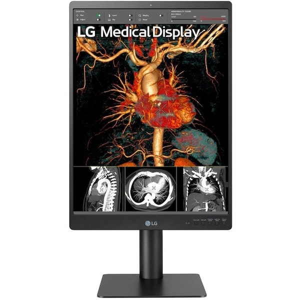 Lg 21 LG MEDICAL IPS 3MP DIAGNOSTIC MONITOR, 2048 X 1536, DVI, USB, DP, DICOM14, CA - 21HQ513D-B