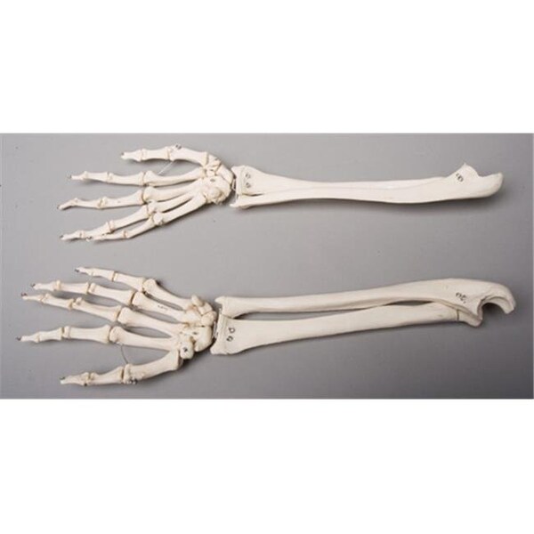 Skeletons And More Skeletons and More SM372DR Right Forearm - SM372DR